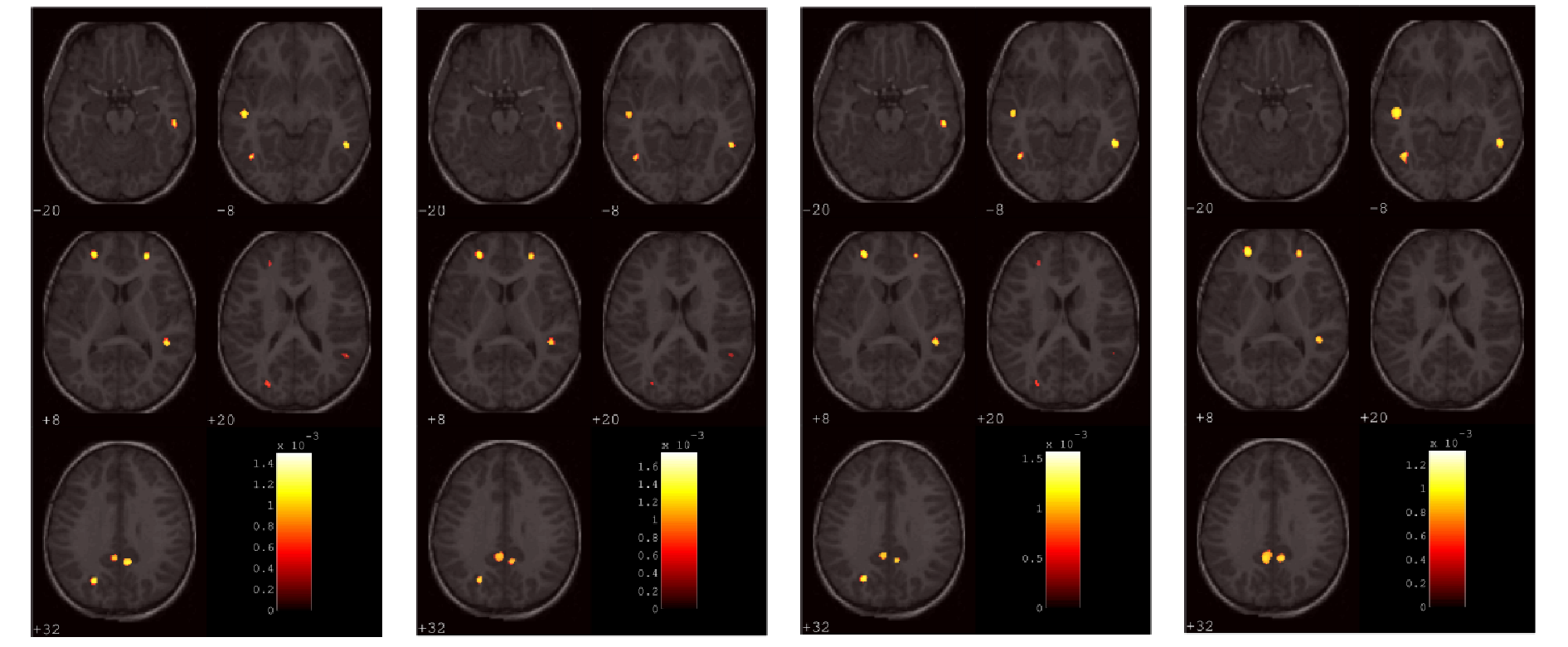 Medical Imaging and Instrumentation Group
